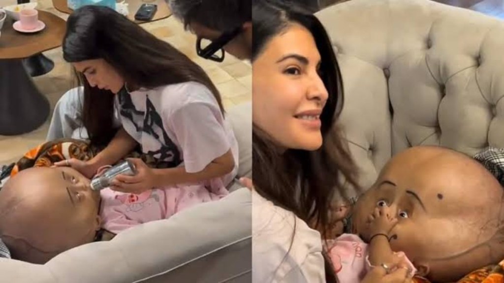Jacqueline Fernandez Wins Hearts by Funding Surgery of Child with Rare Disorder, Deets&nbsp;Inside